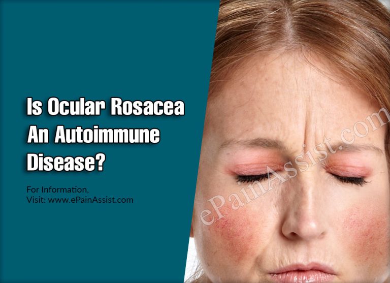Is Ocular Rosacea An Autoimmune Disease & Does It Cause Blindness?