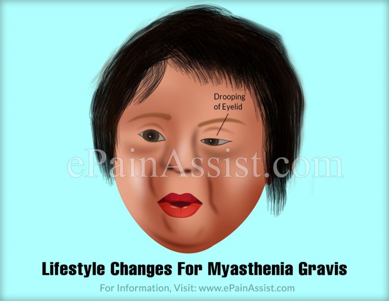 Lifestyle Changes For Myasthenia Gravis