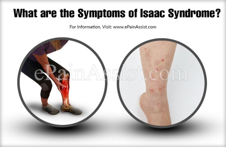 Isaac Syndrome – Causes, Symptoms, Treatment