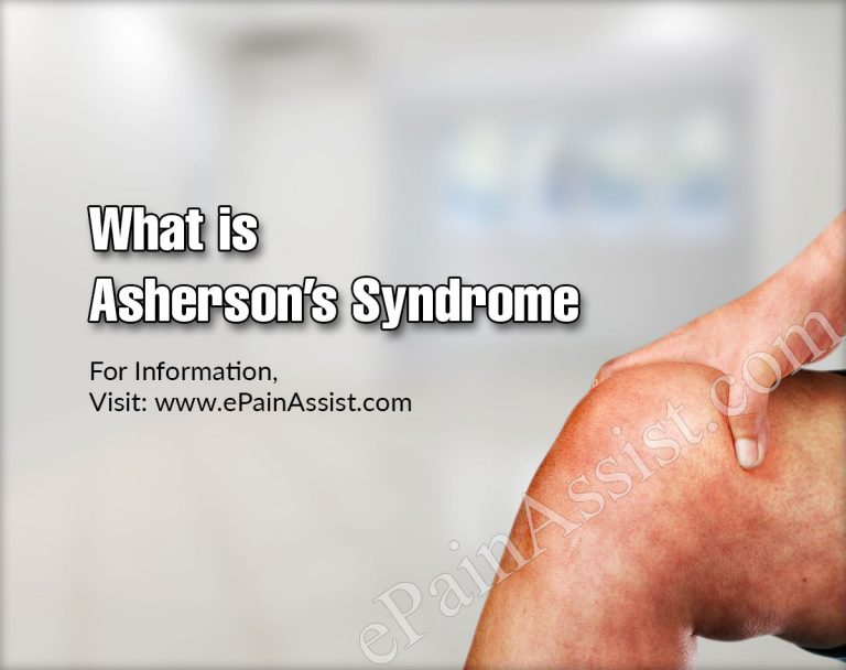 What is Asherson’s Syndrome: Symptoms, Causes, Diagnosis, Treatment