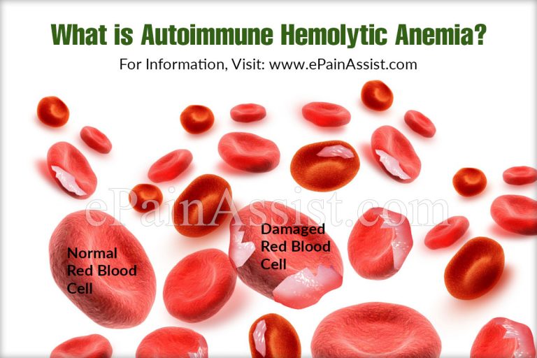 What is Autoimmune Hemolytic Anemia: Causes, Symptoms, Treatment, Diagnosis