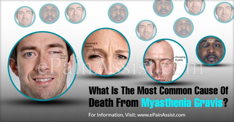 What Is The Most Common Cause Of Death From Myasthenia Gravis?
