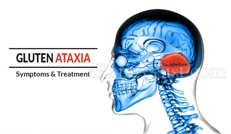 Gluten Ataxia – Symptoms & Treatment