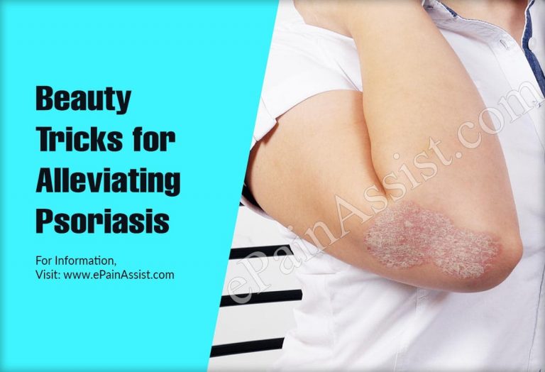 Beauty Tricks for Alleviating Psoriasis