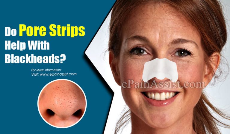 Do Pore Strips Help With Blackheads?