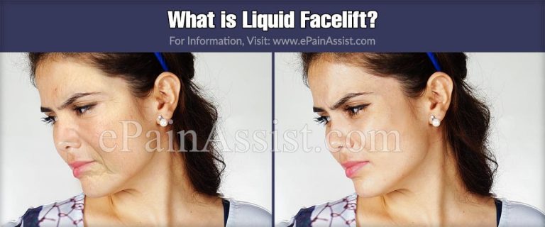 What is Liquid Facelift & How is it Performed?|Guidelines, Risks, Side Effects of Liquid Facelift