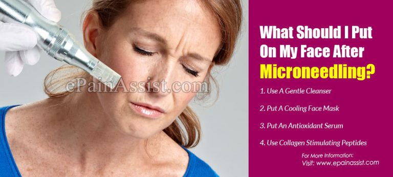 What Should I Put On My Face After Microneedling?