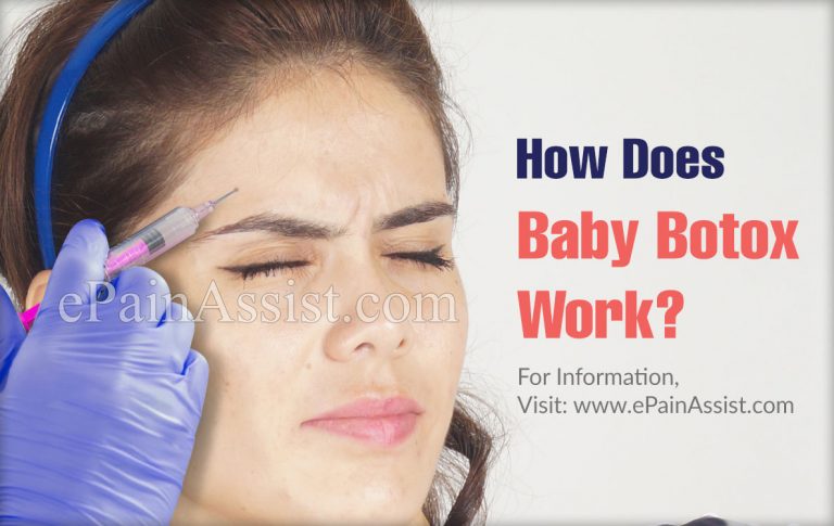 What is Baby Botox & How Does it Work? | Side Effects of Baby Botox