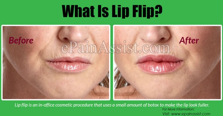 What Is Lip Flip, How is the Procedure Done & How Long Does The Effect of Lip Flip Procedure Last?