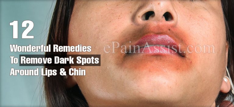 12 Wonderful Remedies To Remove Dark Spots Around Lips and Chin