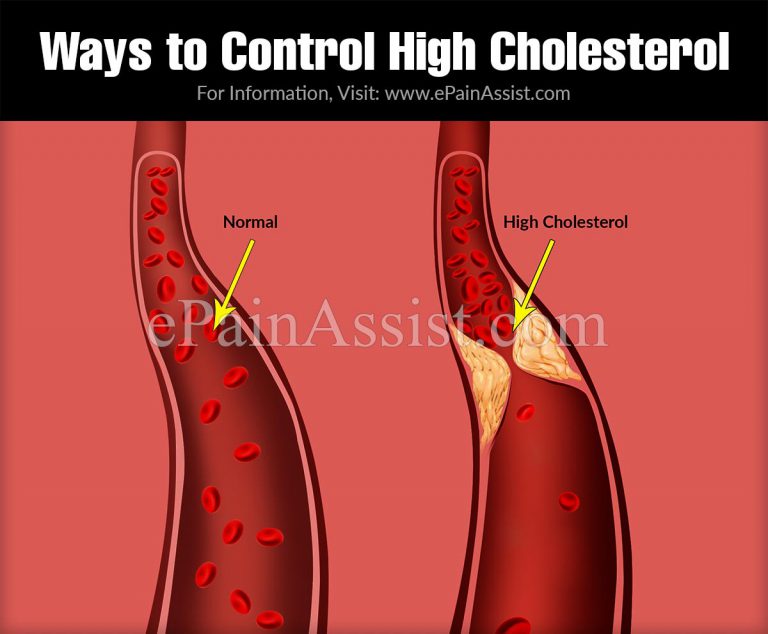 Cholesterol Basics & Ways to Control High Cholesterol