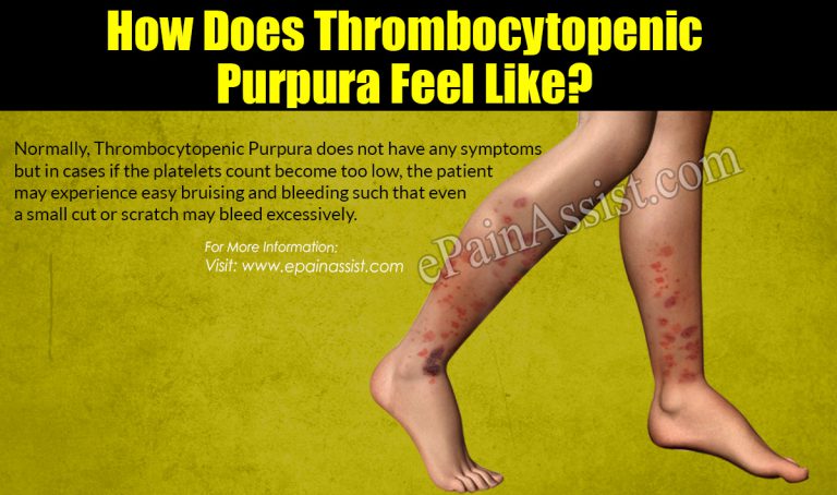 How Does Thrombocytopenic Purpura Feel Like?