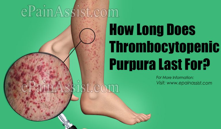 How Long Does Thrombocytopenic Purpura Last For?