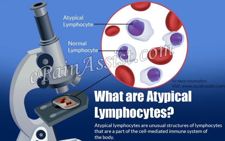 What are Atypical Lymphocytes & How are they Treated?|Causes, Home Remedies for Atypical Lymphocytes