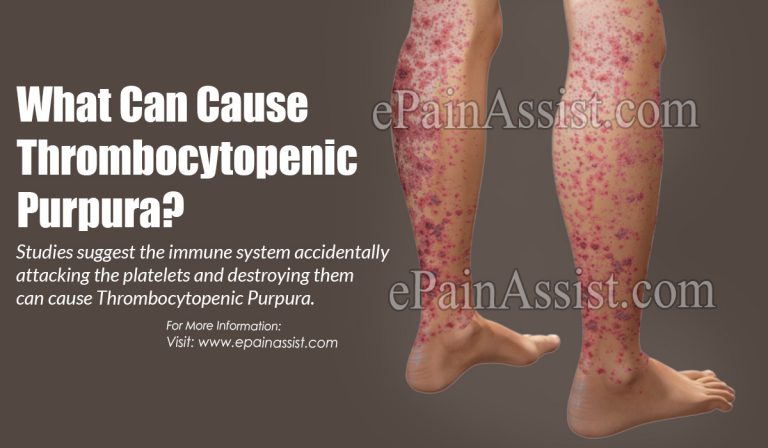 What Can Cause Thrombocytopenic Purpura?