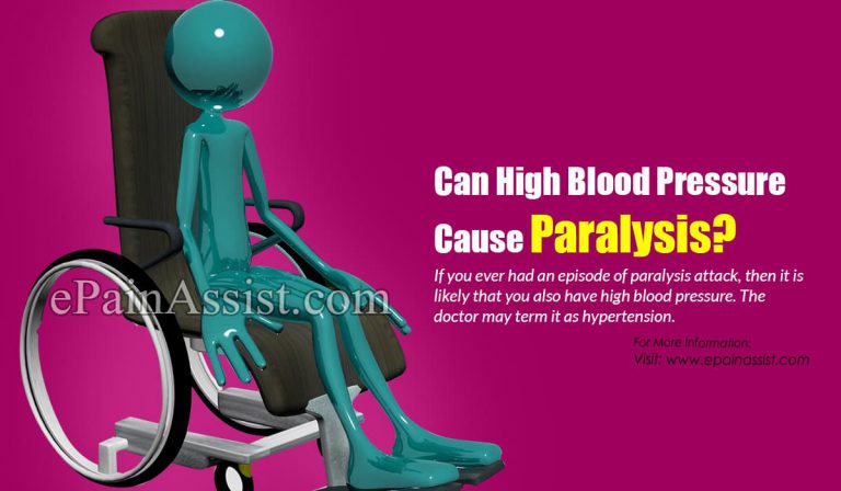 Can High Blood Pressure Cause Paralysis?