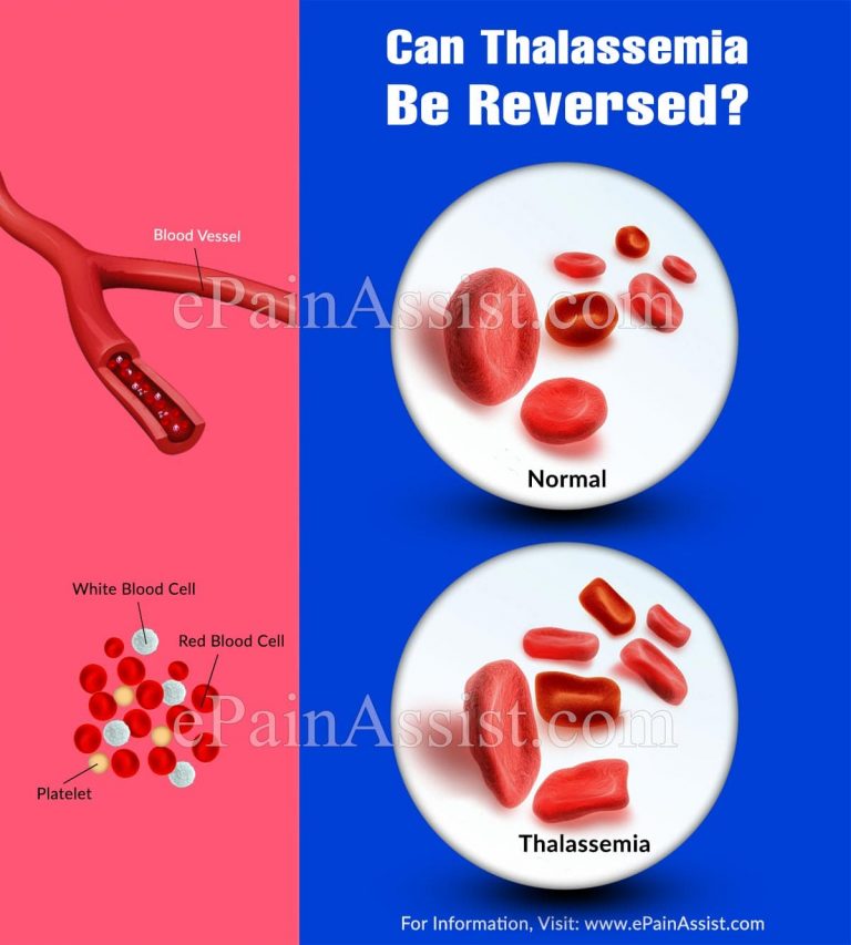 Can Thalassemia Be Reversed?