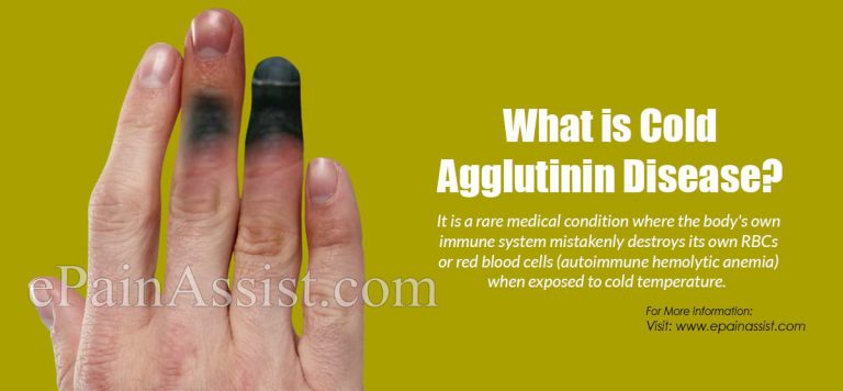 Cold Agglutinin Disease: Causes, Symptoms, Treatment, Risk, Prognosis