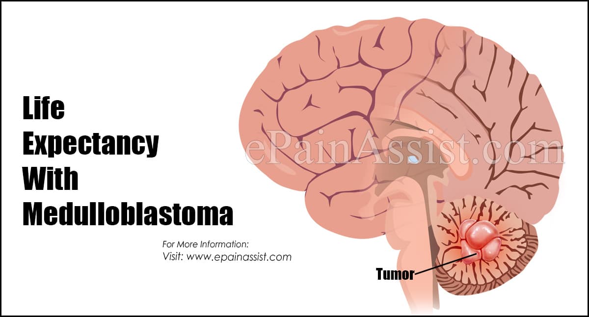 Life Expectancy With Medulloblastoma
