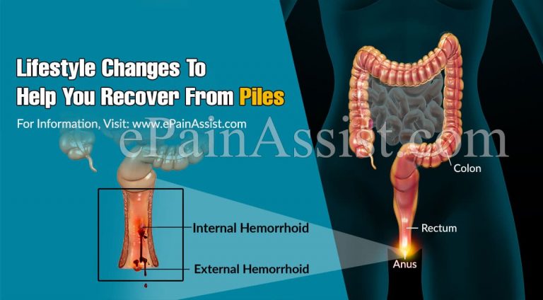 Lifestyle Changes To Help You Recover From Piles