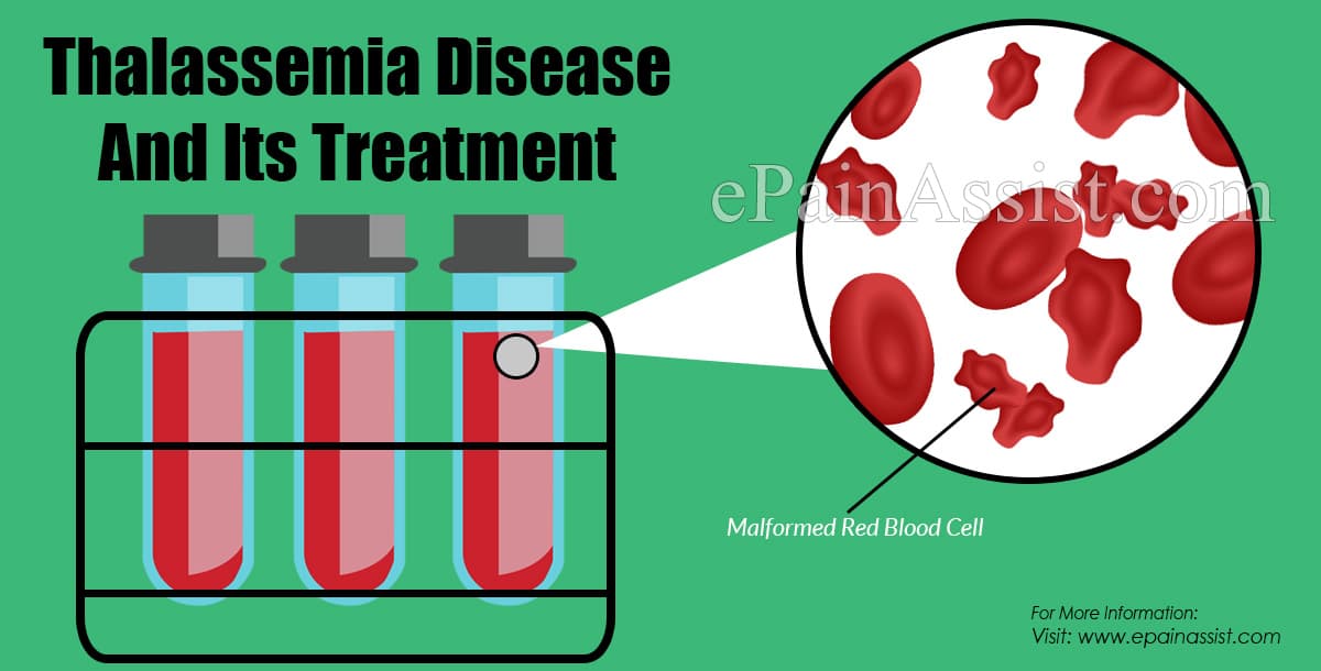 Thalassemia Disease And Its Treatment