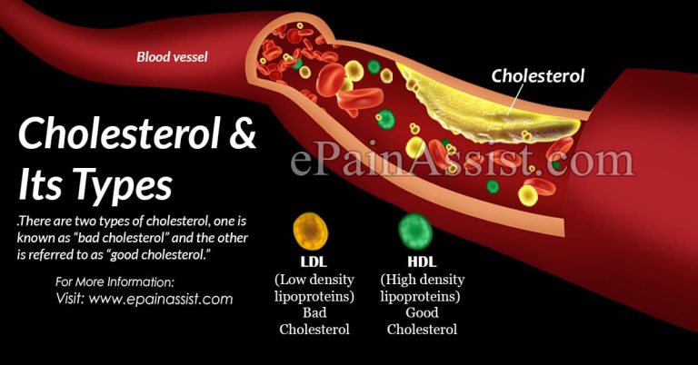 Types of Cholesterol, Its Causes, Symptoms, Treatment, Hypolipidemics Drugs