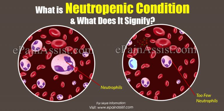 What Is Neutropenic Condition & What Can Make You Neutropenic?|Causes, Symptoms, Treatment Of Neutropenia