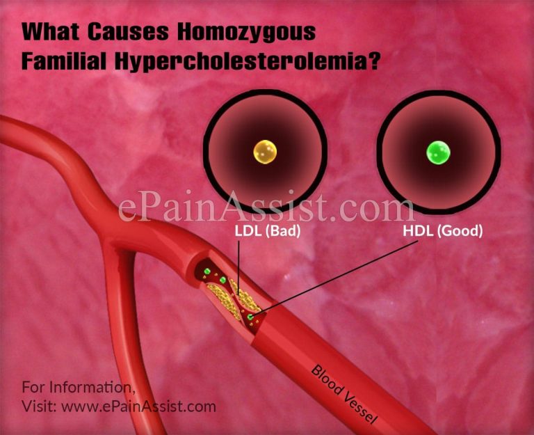 What Causes Homozygous Familial Hypercholesterolemia?