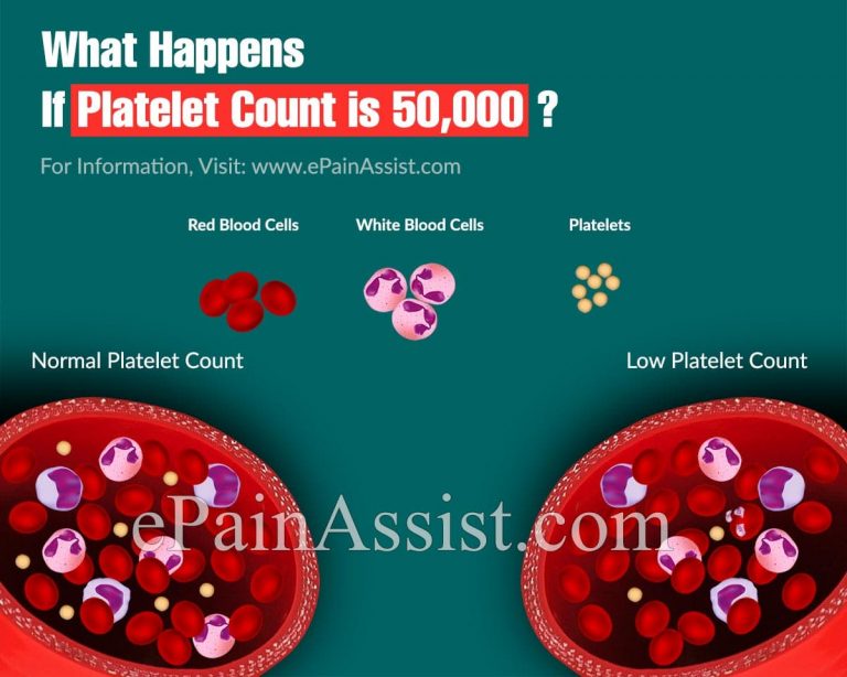 What Happens If Platelet Count is 50,000?