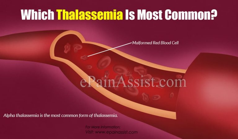 Which Thalassemia Is Most Common?