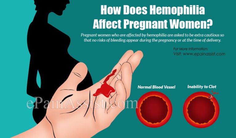 How Does Hemophilia Affect Pregnant Women & How to Manage Hemophilia in Pregnancy?