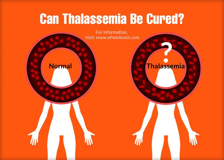 Can Thalassemia Be Cured?
