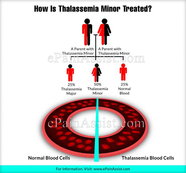 How Is Thalassemia Minor Treated?