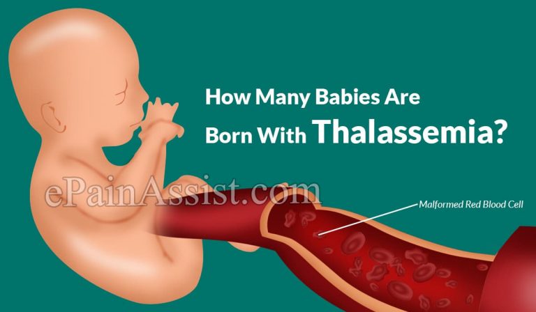 How Many Babies Are Born With Thalassemia?