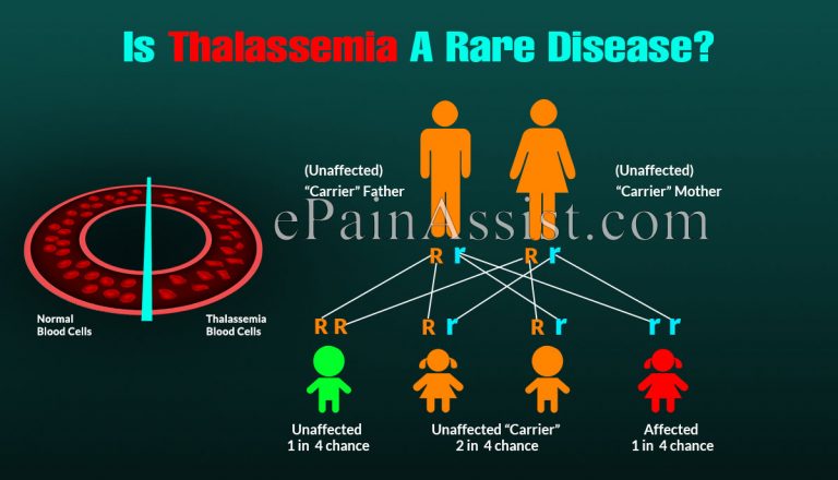 Is Thalassemia A Rare Disease?