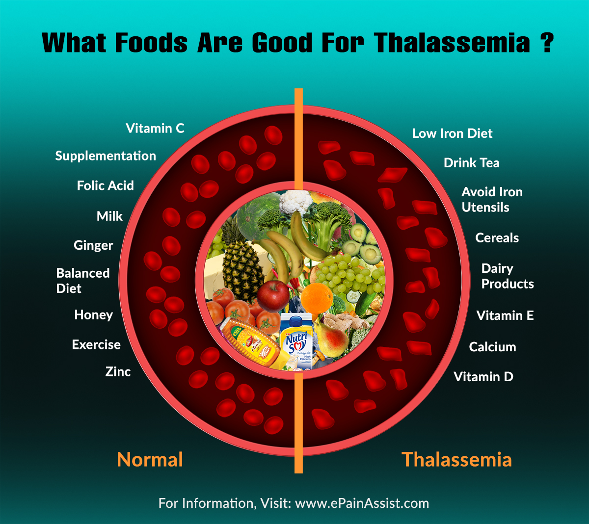 What Foods Are Good For Thalassemia?