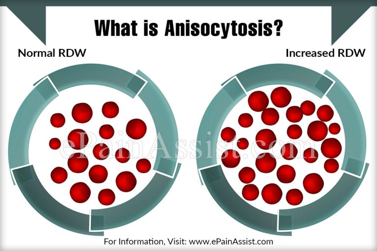 What is Anisocytosis  & How is it Treated? Causes, Symptoms, Prognosis of Anisocytosis