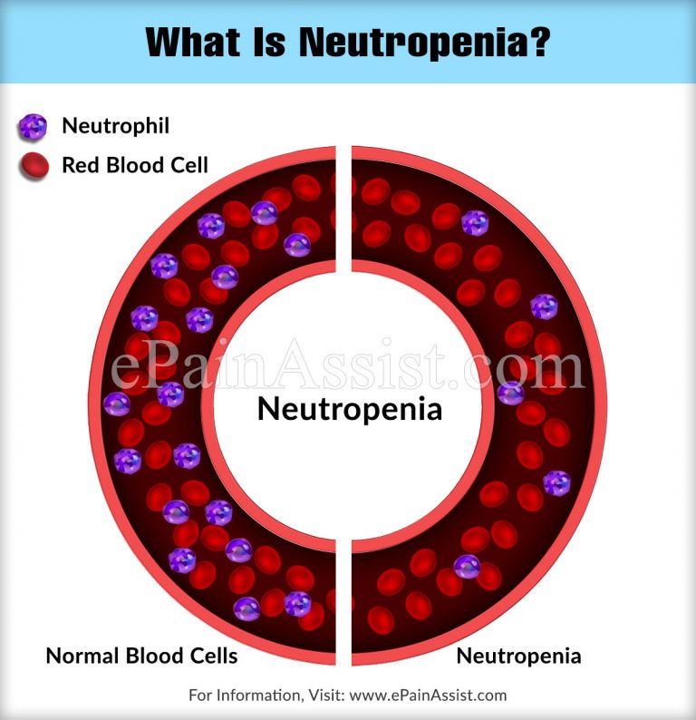 What is Neutropenia & Neutropenic Diet?|Neutropenic Care and Symptom Management