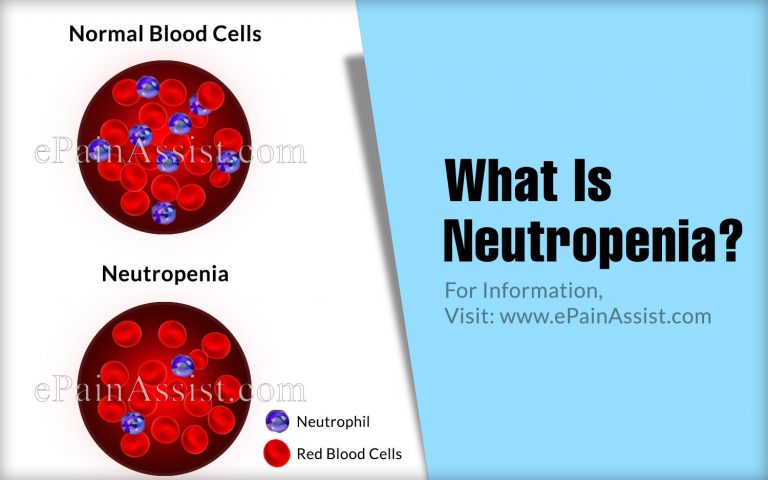 Neutropenia: Causes, Types, Treatment