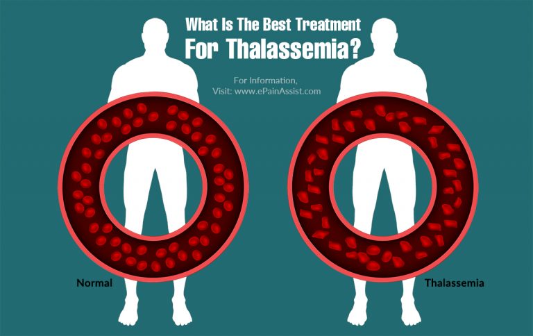 What Is The Best Treatment For Thalassemia?