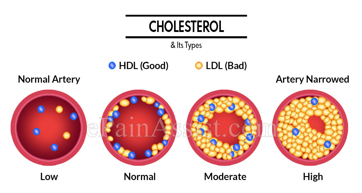 Cholesterol & Its Types Cholesterol & Its Types