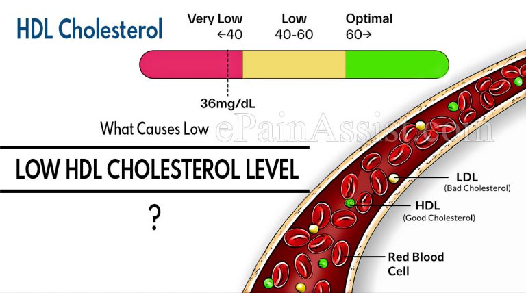 What Causes Low HDL Cholesterol Level?