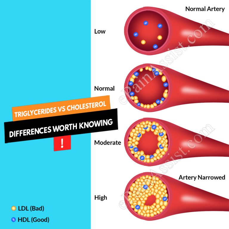 Triglycerides Vs Cholesterol: Differences Worth Knowing