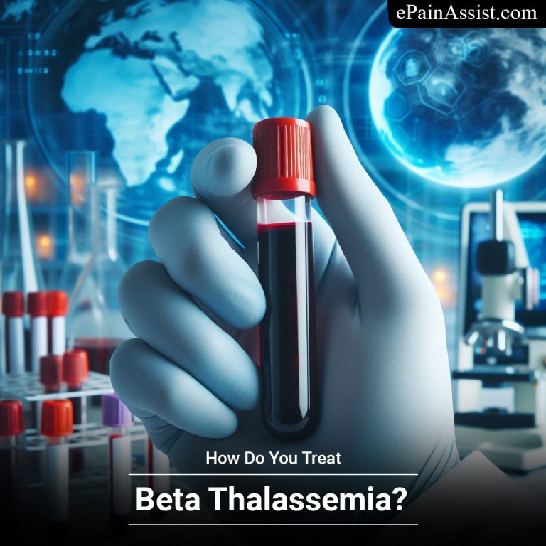 How Do You Treat Beta Thalassemia?