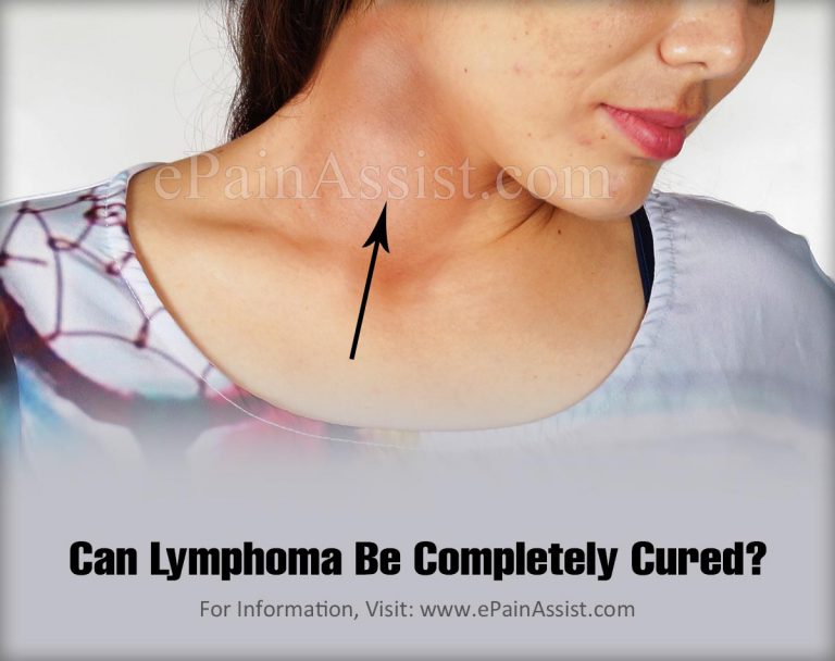 Can Lymphoma Be Completely Cured?