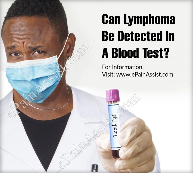 Can Lymphoma Be Detected In A Blood Test?