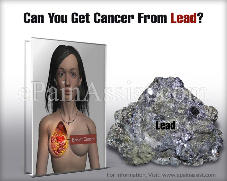 Can You Get Cancer From Lead?