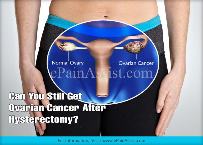 Can You Still Get Ovarian Cancer After Hysterectomy?