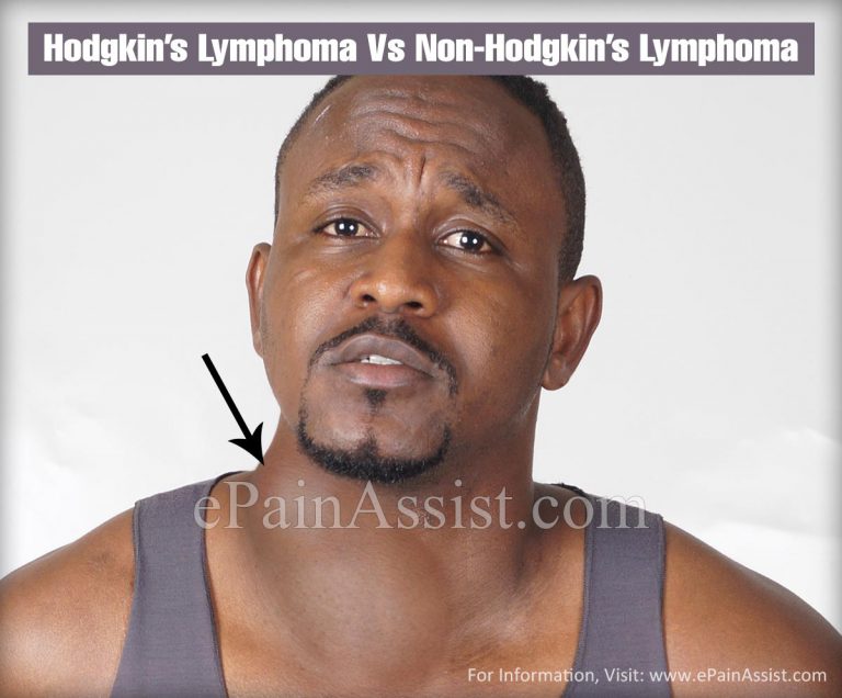 Hodgkin’s Lymphoma Vs Non-Hodgkin’s Lymphoma : Differences Worth Knowing