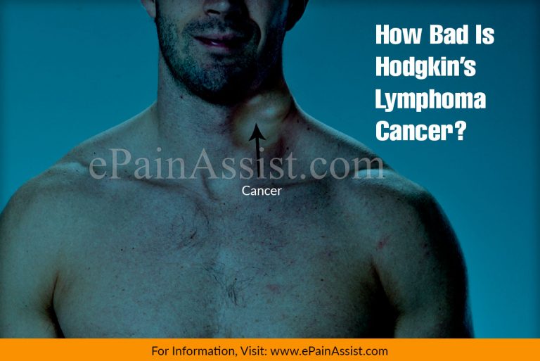 How Bad Is Hodgkin’s Lymphoma Cancer?